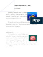 hiperplastia prostatica1.pdf