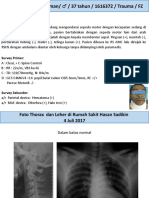 CKR - Motor Vs Motor