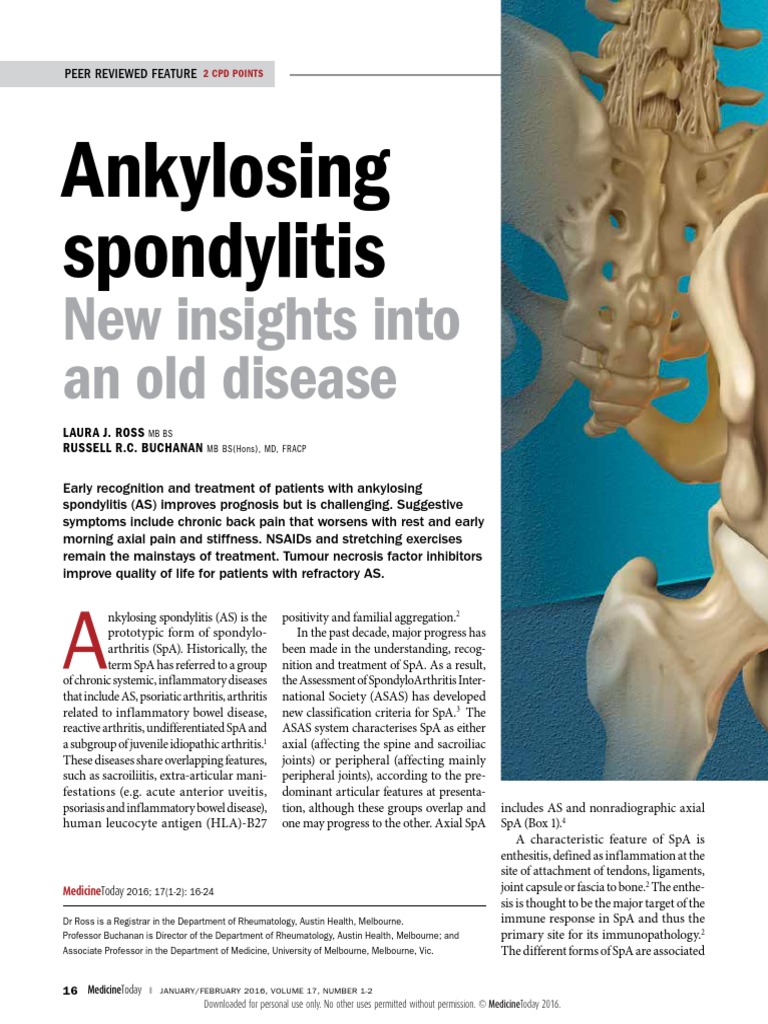 Ankylosing Spondylitis | PDF | Arthritis | Back Pain