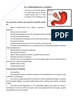 Causas y Consecuencias de La Gastritis