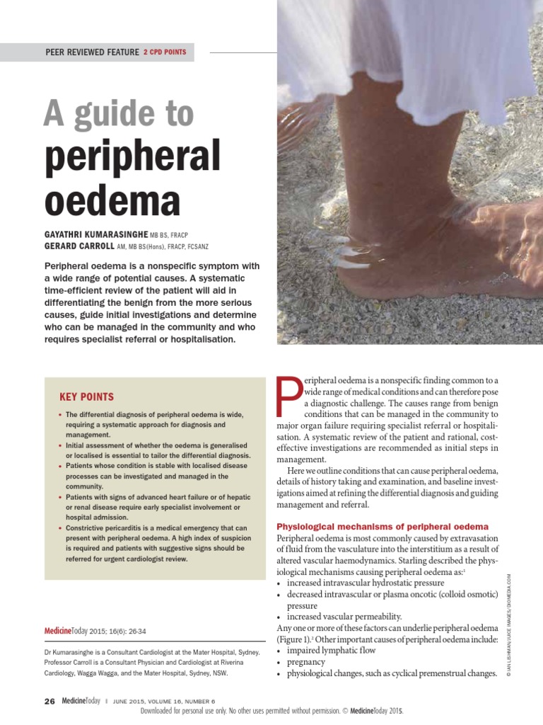 A Guide to Peripheral Edema Edema Vein