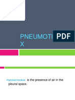 Pneumothorax 141022120943 Conversion Gate02