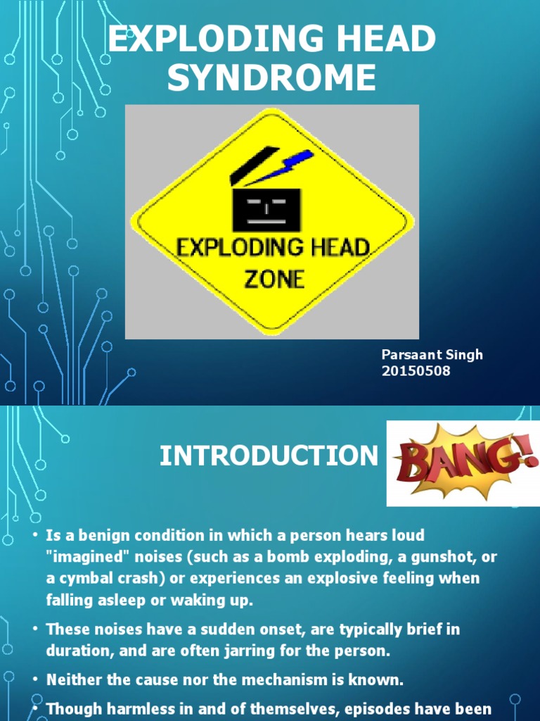 Exploding Head Syndrome PDF Neuroscience Psychopathology