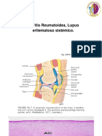 Artritis Reumatoidea y LES