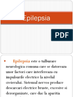 Epilepsia