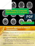 Basic Reading Computed Tomography (CT) of Brain: by Ext