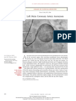 Left Main Coronary Artery Aneurysm: Images in Clinical Medicine