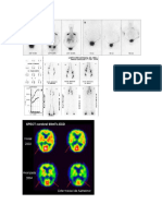 Imagenes de Cintigrama Oseo y Cerebral