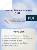 180636450 Sindrom Stevens Johnson Ppt