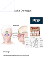 Sinusitis Dentogen