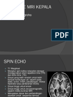 Severe Hydrocephalus