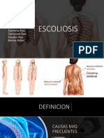 E Scoliosis