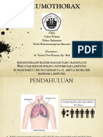 Pneumothorax Ppt