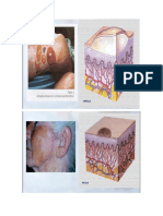 lesiones cutaneas primarias