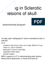 Sclerotic Lesions Skull 