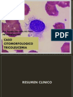 Citomorfologia Tricoleucemia