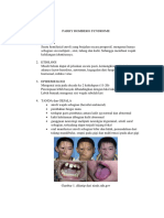 Parry Romberg Syndrome