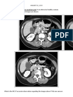 AUGUST 30, 2000 History: A Full Day of Right Upper Quadrant Pain in An Otherwise Healthy Woman. CT Was Performed and Selected Images Are Shown