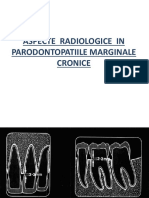 09 Parodontopatii Marginale