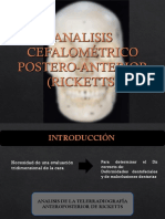 Analisis Cefalometrico Postero-Anterior (Ricketts) 2