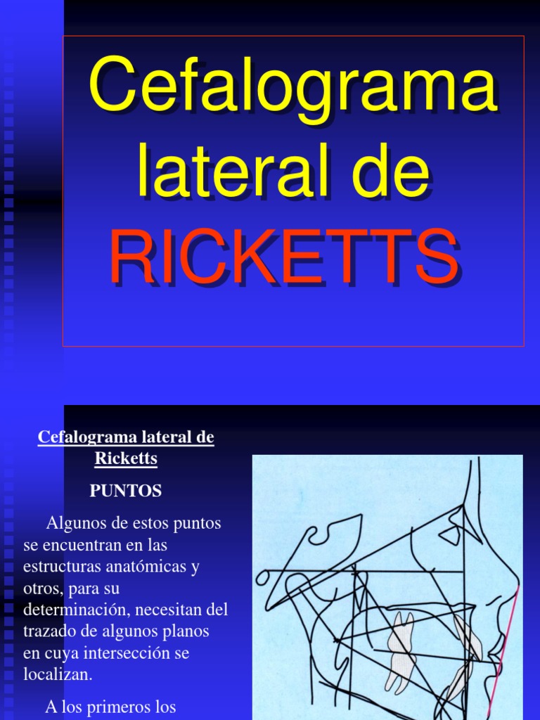 Análisis Cefalométrico de Ricketts | PDF | Anatomía humana | Ramas de ...