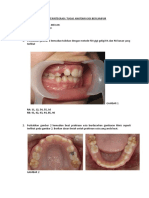 Tugas Mixed Dentition 