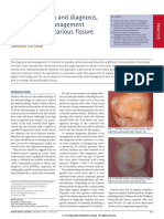 Caries Detection and Diagnosis%2c Sealants and Management of the Possibly Carious Fissure