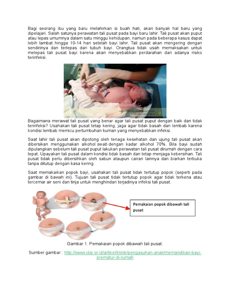 Cara Merawat Tali  Pusat  Yang Terinfeksi Berbagi Rawat Cara Merawat Tali  Pusat  Yang Terinfeksi Berbagi Rawat