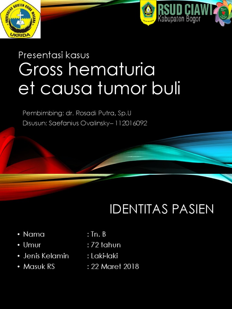 Case Tumor Buli Sky Dr Rosadi 1