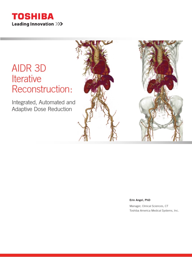 CT WP AIDR 3D Iterative Reconstruction Dose Reduction 2012 | PDF | Ct ...