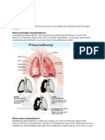 What Is A Pneumothorax?