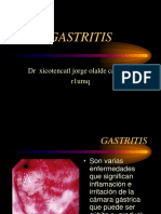 Gastritis