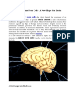 Suppressing Glioma Stem Cells - A New Hope For Brain Cancer Patients