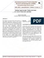 Bile Leakage During Laparoscopic Cholecystectomy A Rare Case of Aberrant Anatomy