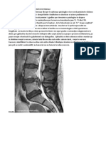 Anatomia Aksiale e Diskut Intervertebrale