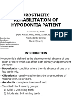 Prostho Rehabilitation - Hypodontia
