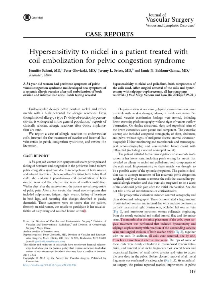 Hypersensitivity To Nickel in A Patient Treated With Coil Embolization For Pelvic Congestion