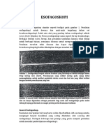 Esofagoskopi Teknik dan Keamanan