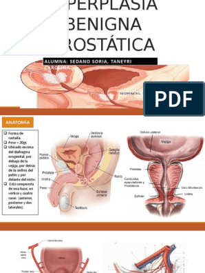 tratament naturist cancer prostata metastaze utilizarea levitra pentru prostatită
