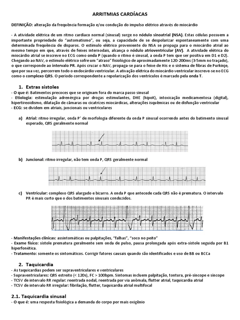 Arritmias Cardíacas | PDF | Eletrocardiografia | Arritmia cardíaca