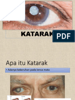 Penyuluhan Katarak