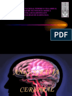 Angiografia Cerebral DX