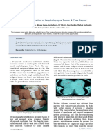 Successful Separation of Omphalopagus Twins: A Case Report