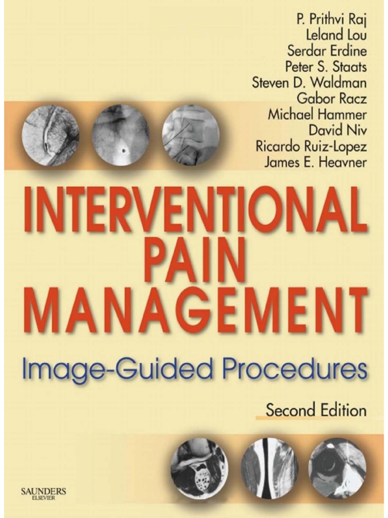 Interventional Pain Management PDF Radiology Anesthesia