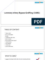 Coronary Artery Bypass Grafting (CABG)