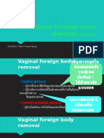 Vaginal Foreign Body Removal Adult