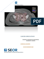 CANCER GINECOLOGICO Tratamientos y Cuidados