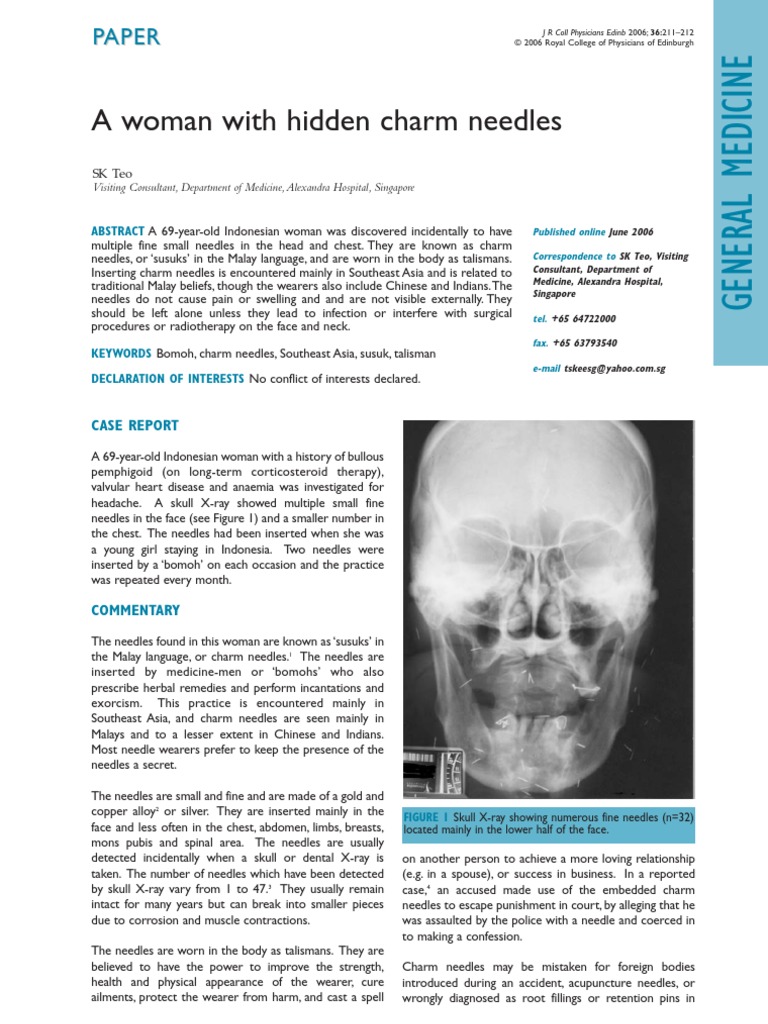 susukxray Acupuncture X Ray