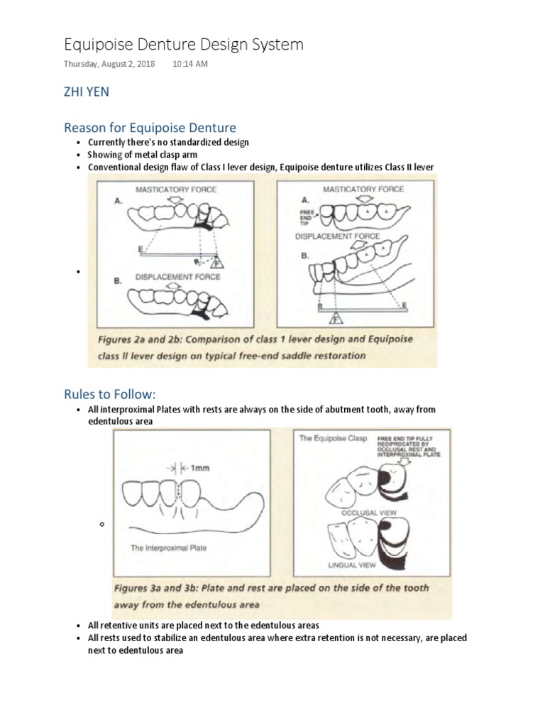 Equipoise Denture PDF Dentures Tooth