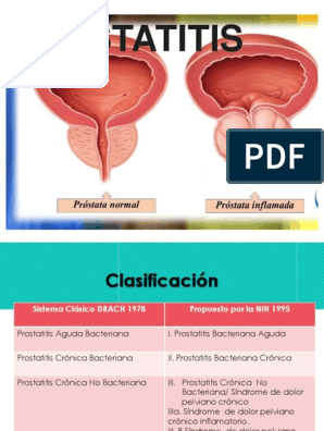 prostatitis bacteriana crónica pdf